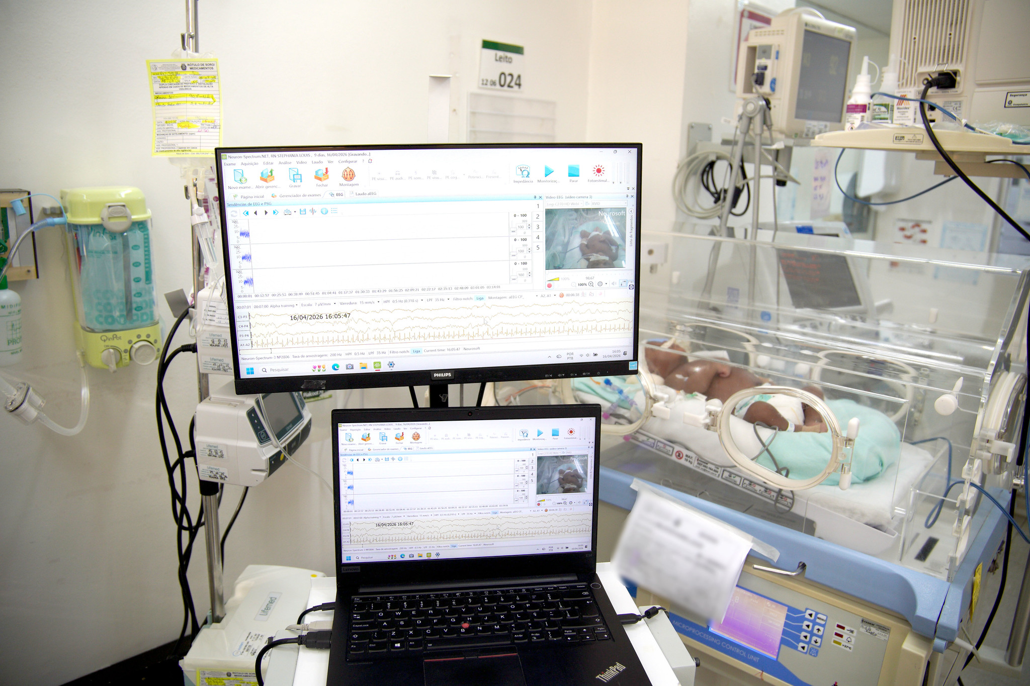 Fotografia em plano médio, tirada dentro de uma Unidade de Terapia Intensiva Neonatal (UTIN), focada na tecnologia de neuromonitorização. Em primeiro plano, sobre um carrinho de equipamentos, repousa um notebook com a tela aberta exibindo um software de EEG (eletroencefalograma), com traçados de ondas cerebrais coloridas em tempo real. Diretamente acima, um monitor maior exibe, de forma espelhada, a mesma interface do software de EEG, confirmando a leitura. Ao fundo, ligeiramente desfocado, vê-se um recém-nascido deitado dentro de uma incubadora transparente, com diversos fios e sensores conectados, indicando o monitoramento constante. O ambiente é clínico, com tons claros, outros equipamentos médicos e uma placa de identificação do leito visível na parede.